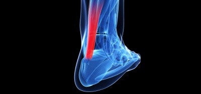 Trénink - běžecké zranění Achillovy šlachy